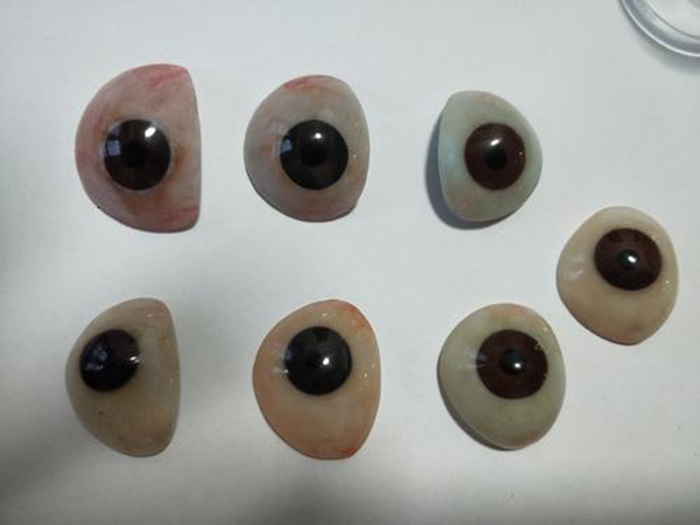 义眼的镶配效果与患者伤眼的自身条件有关
